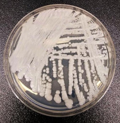 A strain of C. auris cultured in a petri dish. Image courtesy of the CDC. Photo credit: Shawn Lockhart.