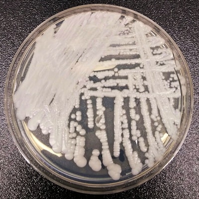 2019 04 12 22 03 3544 Fungus Candida Auris 400