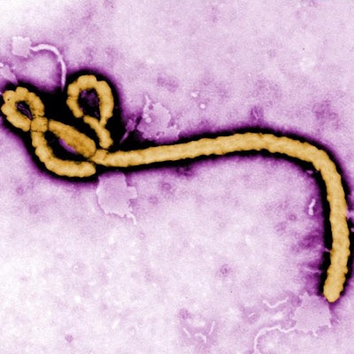 2019 05 03 22 55 1302 Ebola 400