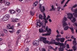 2019 07 09 22 59 7688 2019 07 09 Ucla Small Cell 20190709225433