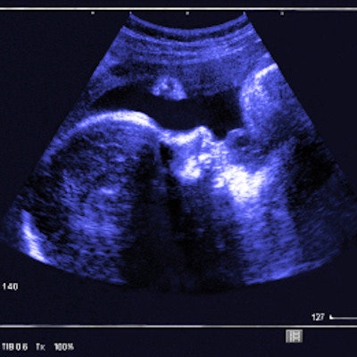 2019 08 29 00 12 0745 Fetal Ultrasound 400