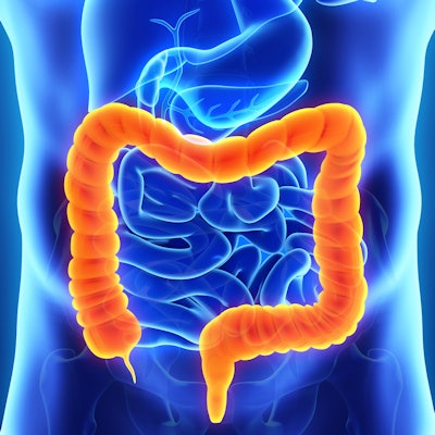 2019 09 23 17 18 0797 Colon Intestine 400