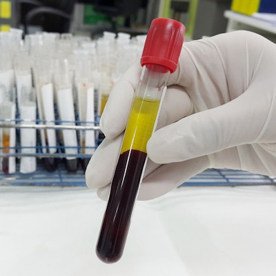 2019 07 25 22 25 7960 Lab Blood Plasma 400