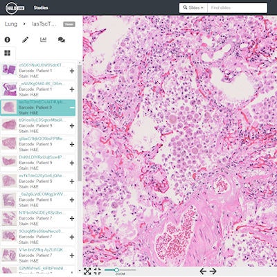 2020 05 21 22 11 7247 Octo Digital Pathology Repository Screengrab 400