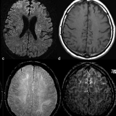 2020 05 13 20 53 8134 2020 05 14 Brain Mri Covid Figure 2 400