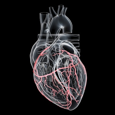 2020 08 26 19 10 8097 Artery Heart 3 D 400