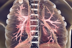 2019 12 03 00 00 5470 Tuberculosis Lungs 400