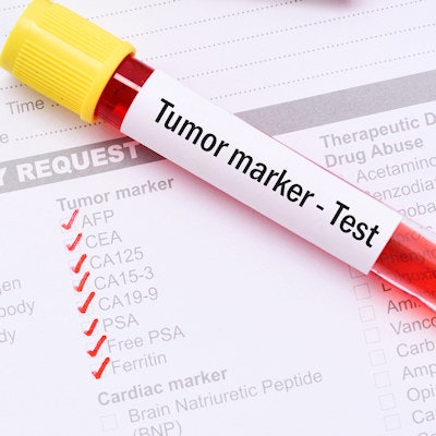 2021 06 07 23 26 6198 Blood Tube Tumor Marker Test 400