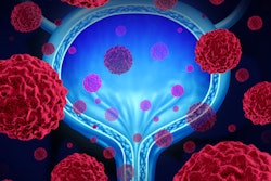 2019 05 09 16 46 9205 Bladder Cancer 400