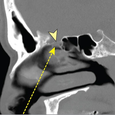 2021 09 09 14 20 4610 2021 09 09 Nejm Knizek Swab Injury 400