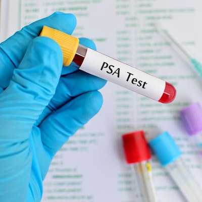 2021 11 13 00 11 7867 Diagnostic Test Sample Psa Prostate 400