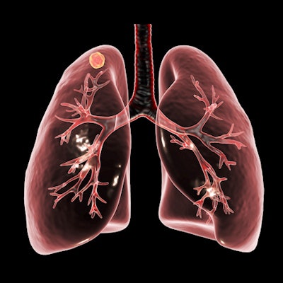 2022 01 11 22 22 7293 Lung Tuberculosis Art 400