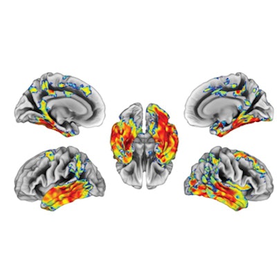 2022 03 02 20 27 6315 2022 03 04 Tau Biomarkers 400