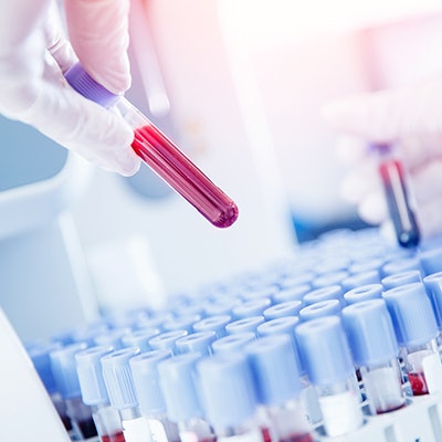 2021 01 12 23 44 3780 Blood Test Samples Lab 400