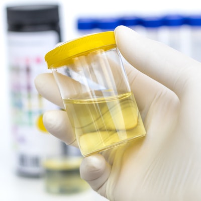 2019 05 02 19 24 6251 Lab Urine Test 400