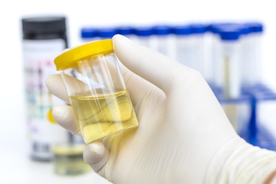 Lab Urine Test