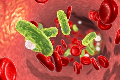 Bacteria Blood Sepsis