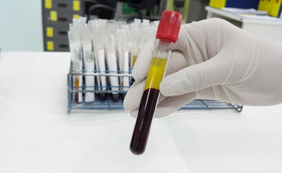 Lab Blood Plasma Resized
