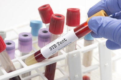 Lab Std Test