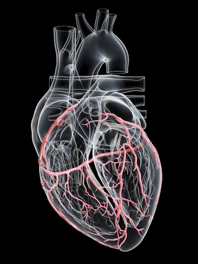 Artery Heart 3 D Resized