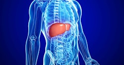 Delfi Diagnostics researchers to present proof-of-concept data for liver  cancer detection platform 