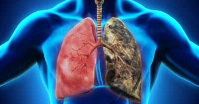 Lung Cancer Social