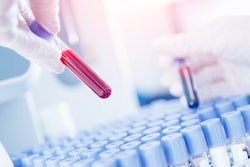 Blood Test Samples Lab Social