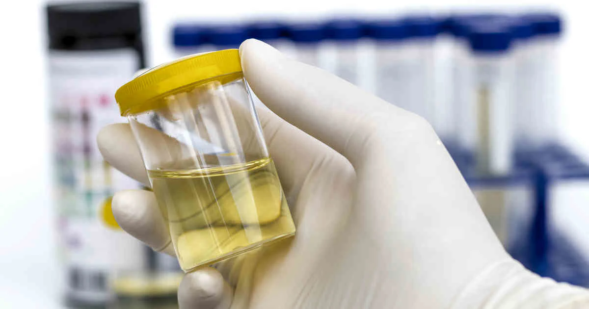 OraSure, nRichDx to offer products for researchers developing urine-based liquid biopsy assays - Vimarsana News
