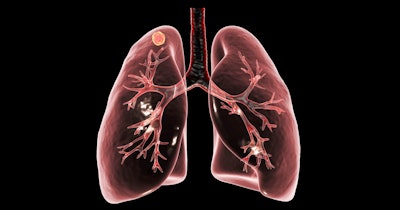 Lung Tuberculosis Art Social