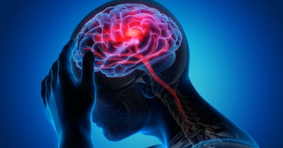 Brain Stroke Stroke Social