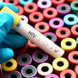 Lab Hiv Test Social