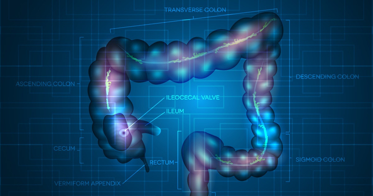 Tempus granted FDA premarket approval for colorectal cancer CDx