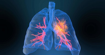 Lung Cancer2 Social