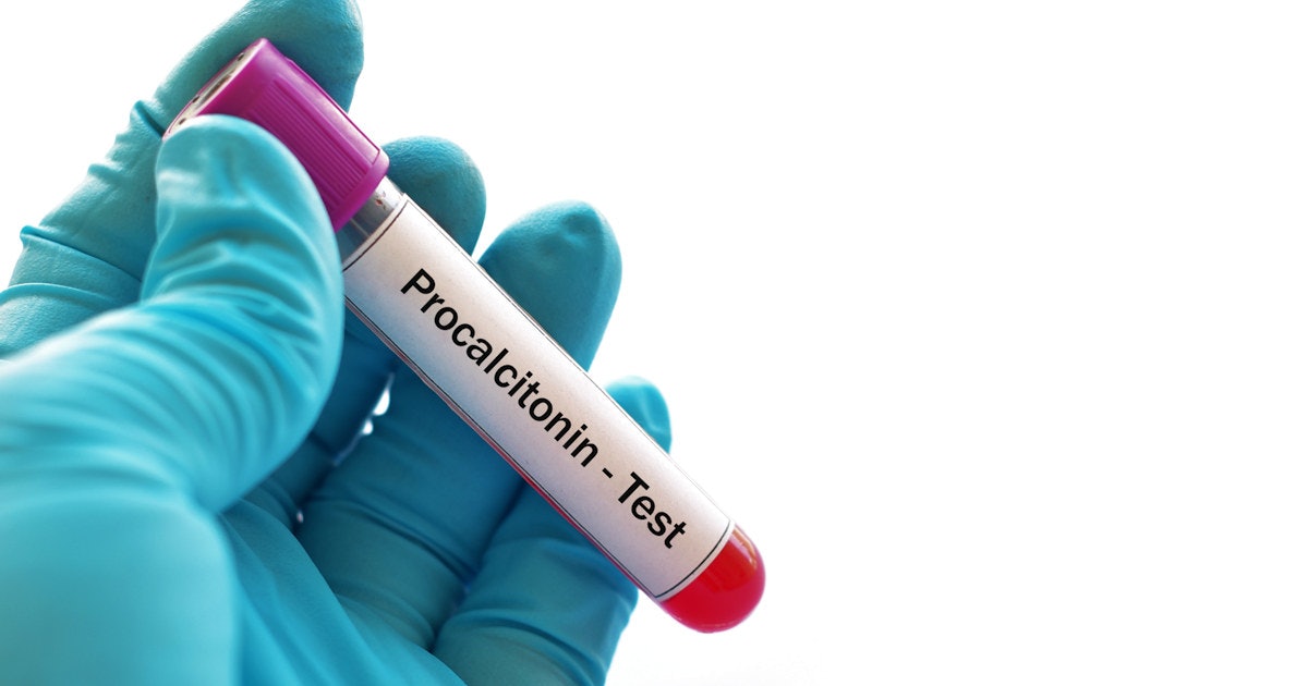 AACC releases guidance on procalcitonin testing for patients with ...