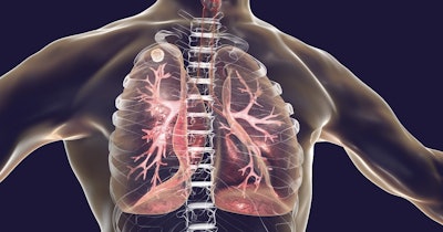 Tuberculosis Lungs Social