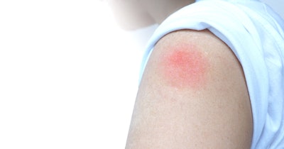 Skin Rash Injection Immunization Social