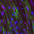 This photo shows green dystrophin protein restored by dual-Cas3 in skeletal muscle derived from DMD patient iPSCs.