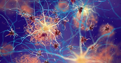 Brain Amyloid Plaque Neuron Social