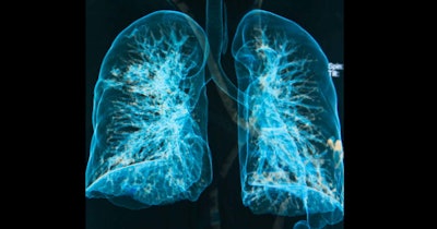 Lung 3 D Social
