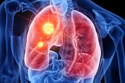 Lung Cancer Hotspot Social