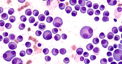 Multiple Myeloma Social