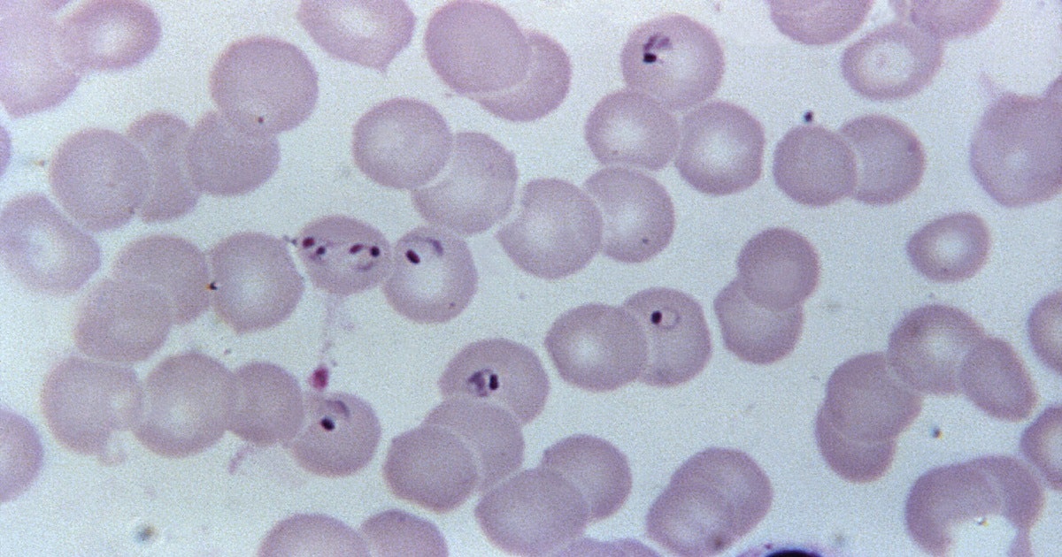 plasmodium falciparum under microscope