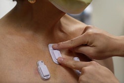 A health care worker places the wearable devices across a patient's chest to capture sounds throughout the lungs that are associated with breathing. Photo courtesy of Northwestern University.