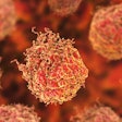 Cancer Cells Prostate Social