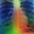 Artificial Intelligence Lung Color Social