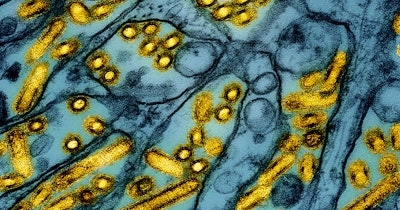 Colorized transmission electron micrograph of avian influenza A H5N1 virus particles (yellow), grown in Madin-Darby Canine Kidney (MDCK) epithelial cells (blue). Microscopy by CDC; repositioned and recolored by NIAID.